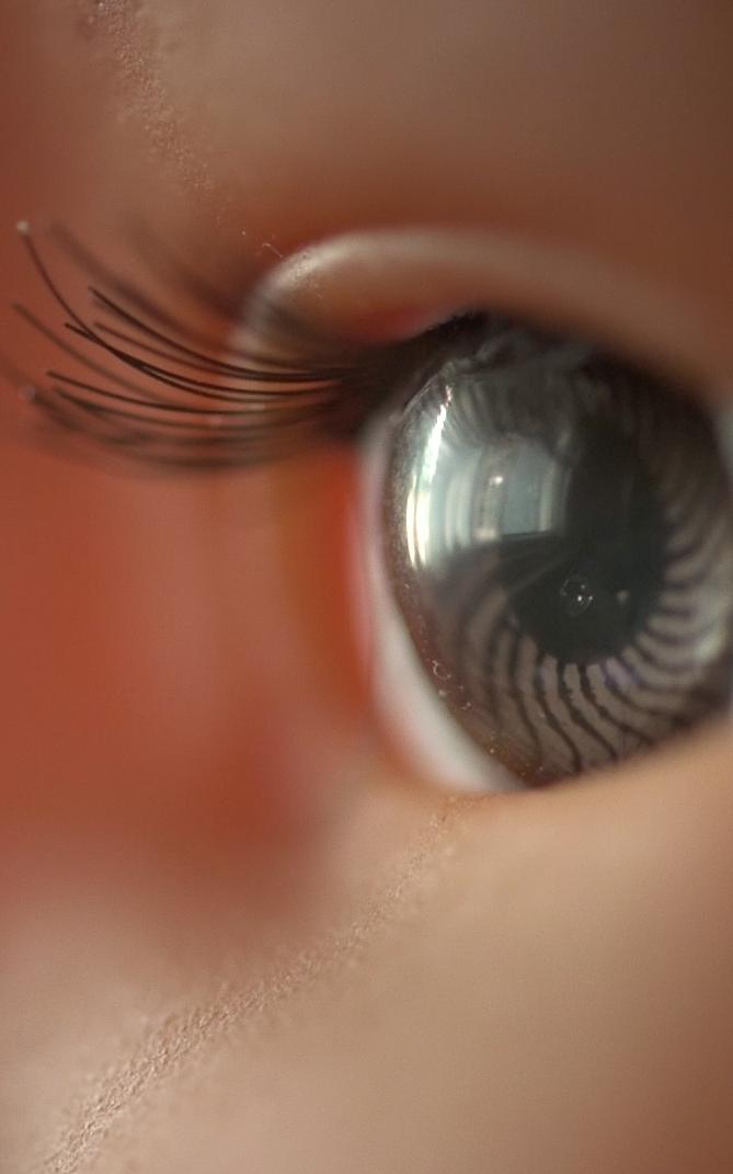 Doll eye