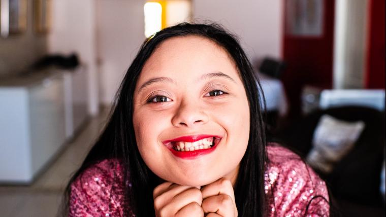 model with Down Syndrome.