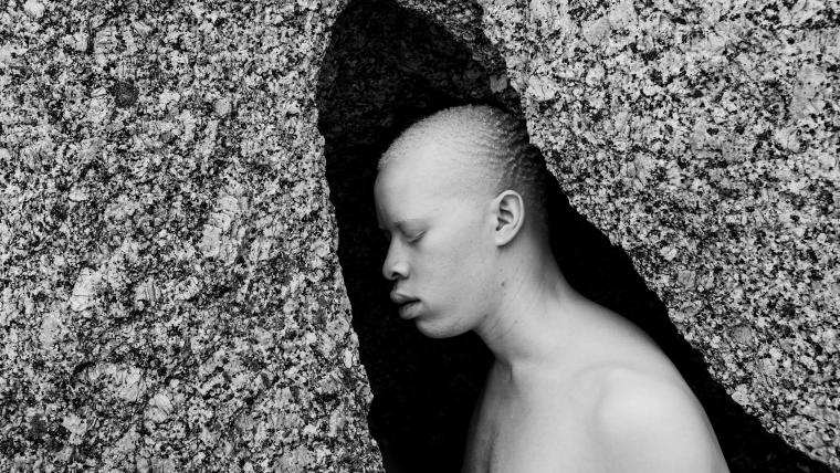 A South African Albino Male Model Is Redefining Catwalk Stereotypes Beautiful News