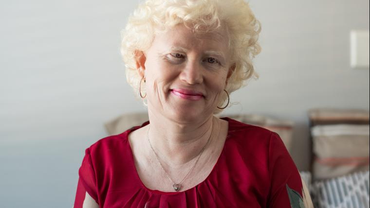negative perceptions of albinism led her to be able to help youth with disabilities to gain confidence.